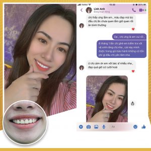 Feedback của khách hàng làm răng tại VNPC