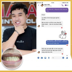 Feedback của khách hàng dán sứ Veneer tại VNPC