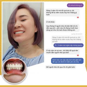 Feedback của khách hàng làm răng tại VNPC