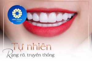 Chỉnh nha Invisalign