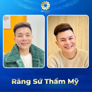 Răng sứ thẩm mỹ
